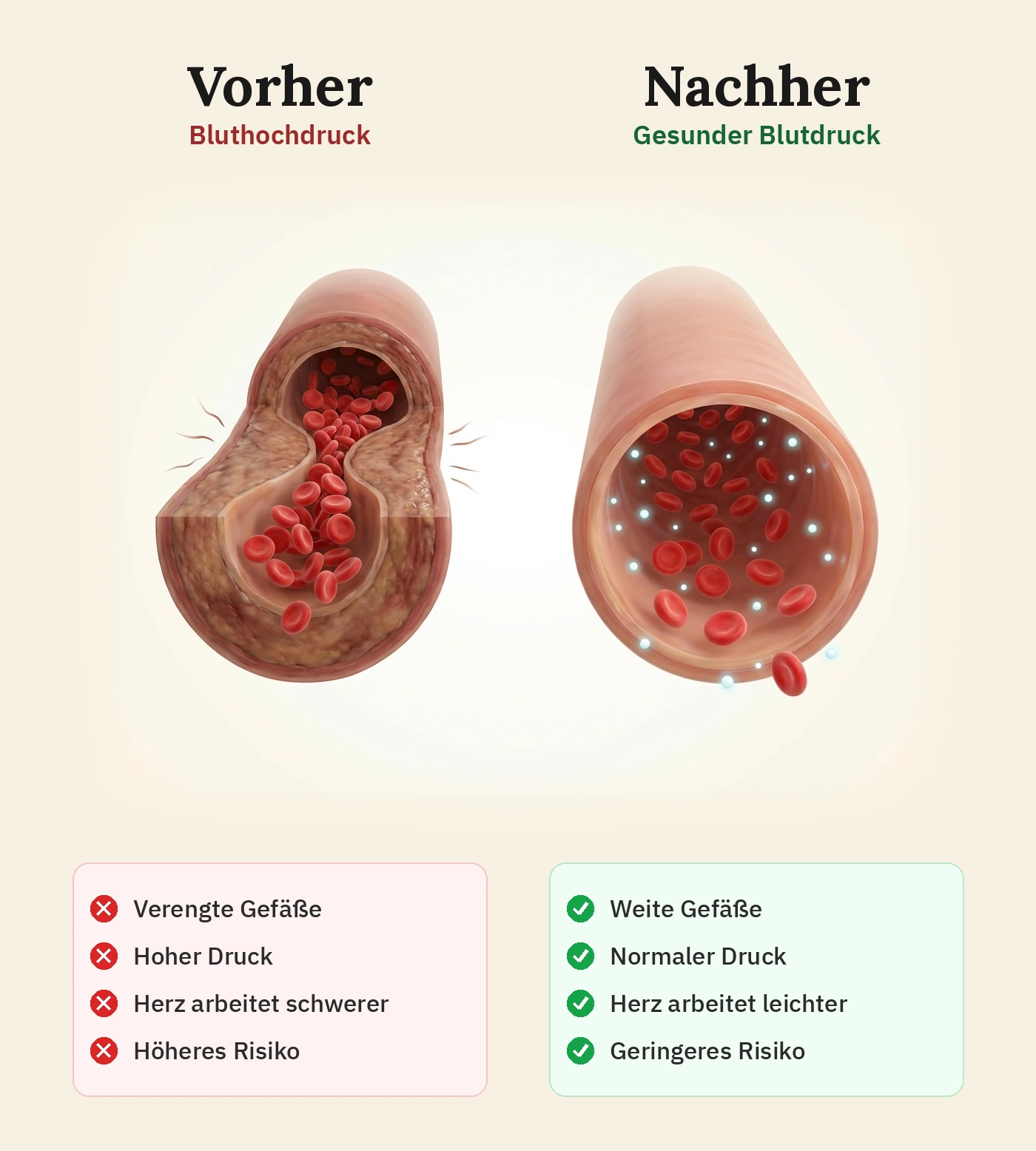 Vorher-Nachher-Vergleich: verengtes Gefäß bei Bluthochdruck vs. entspanntes, weites Gefäß bei gesundem Blutdruck, mit Checkliste