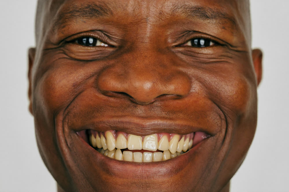 Second example smile before simulation