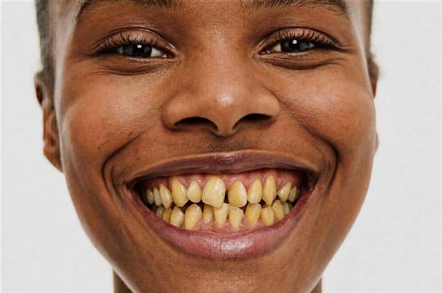 Smile before simulation