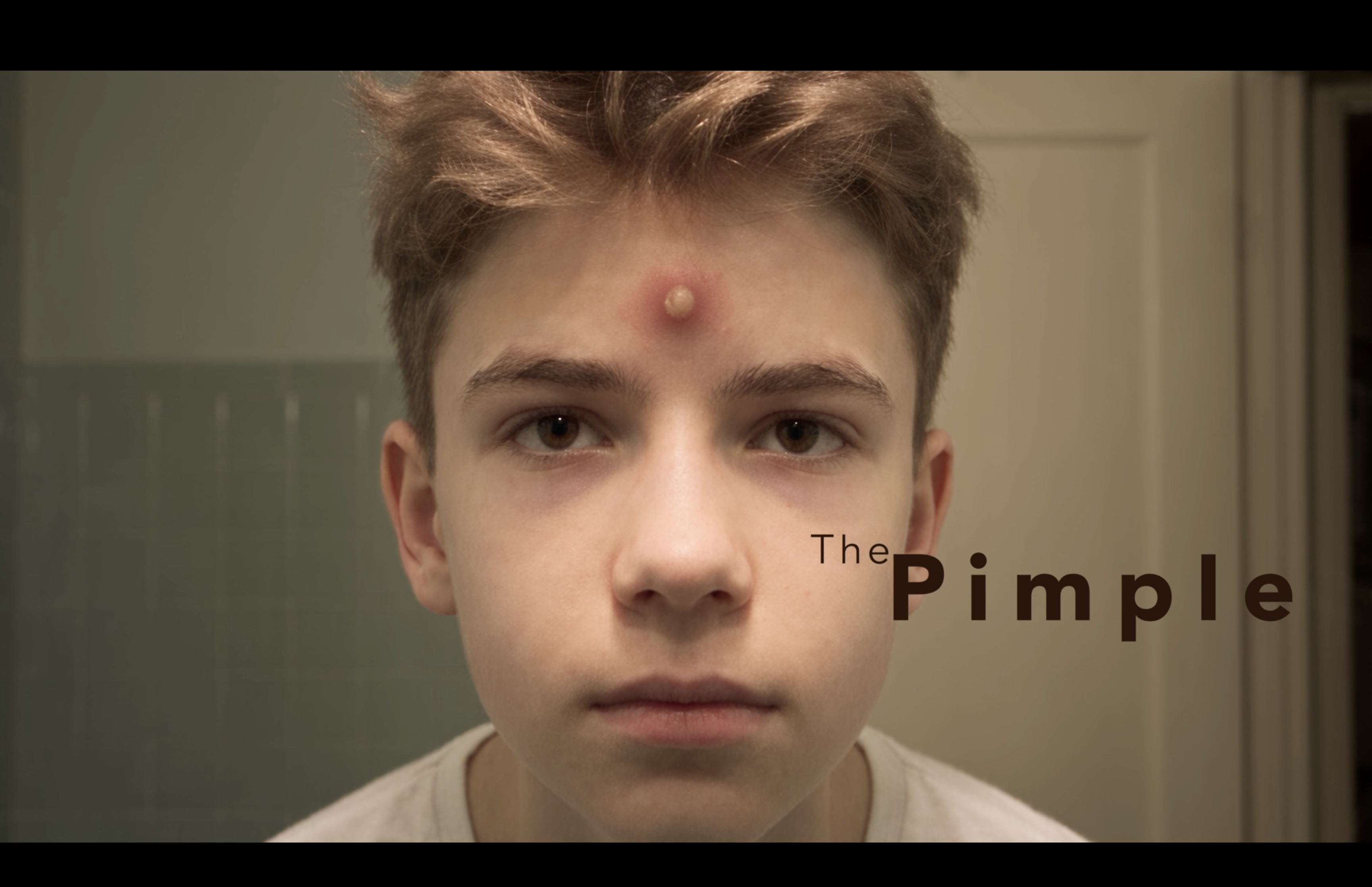 The Pimple
