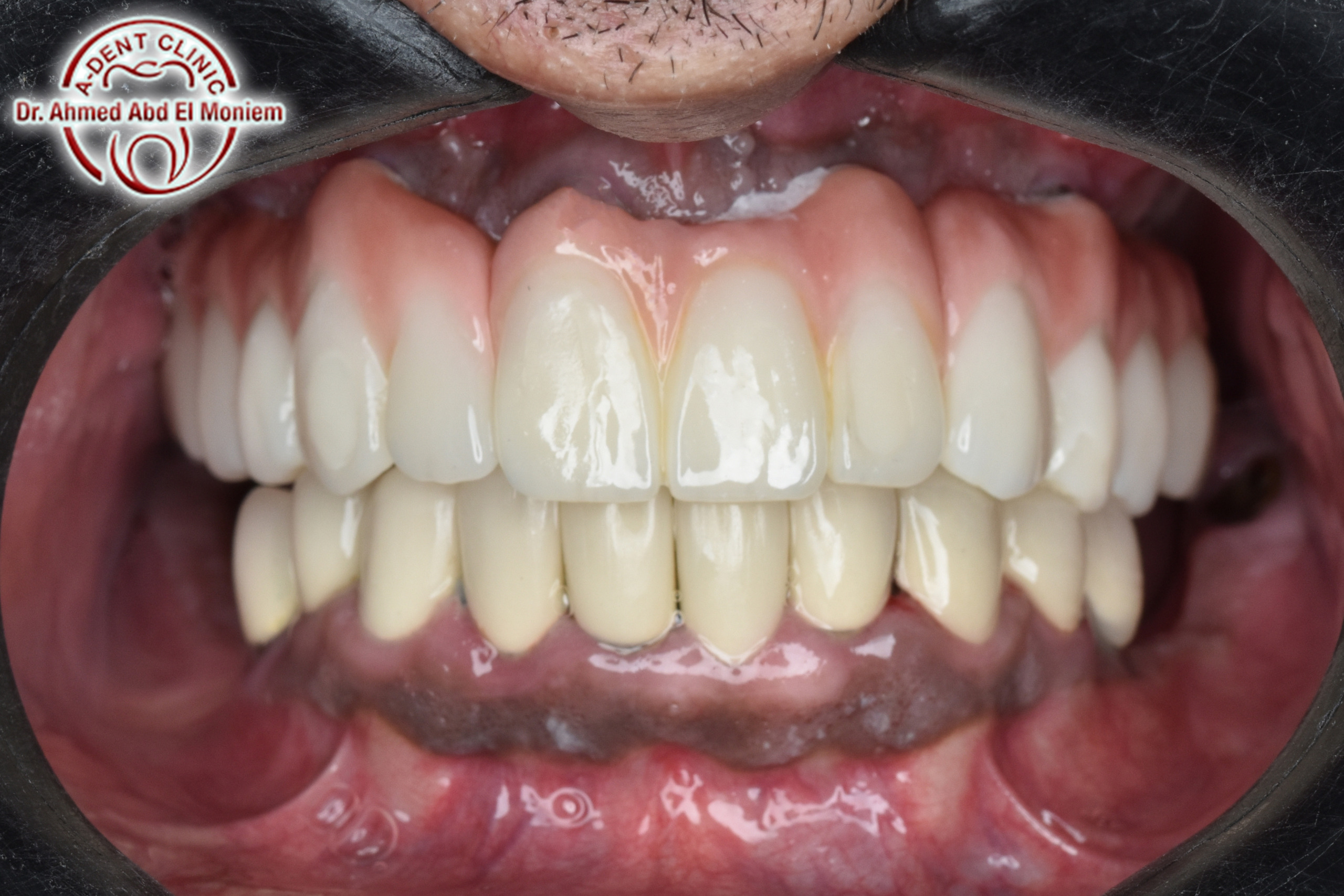 Before: case 17