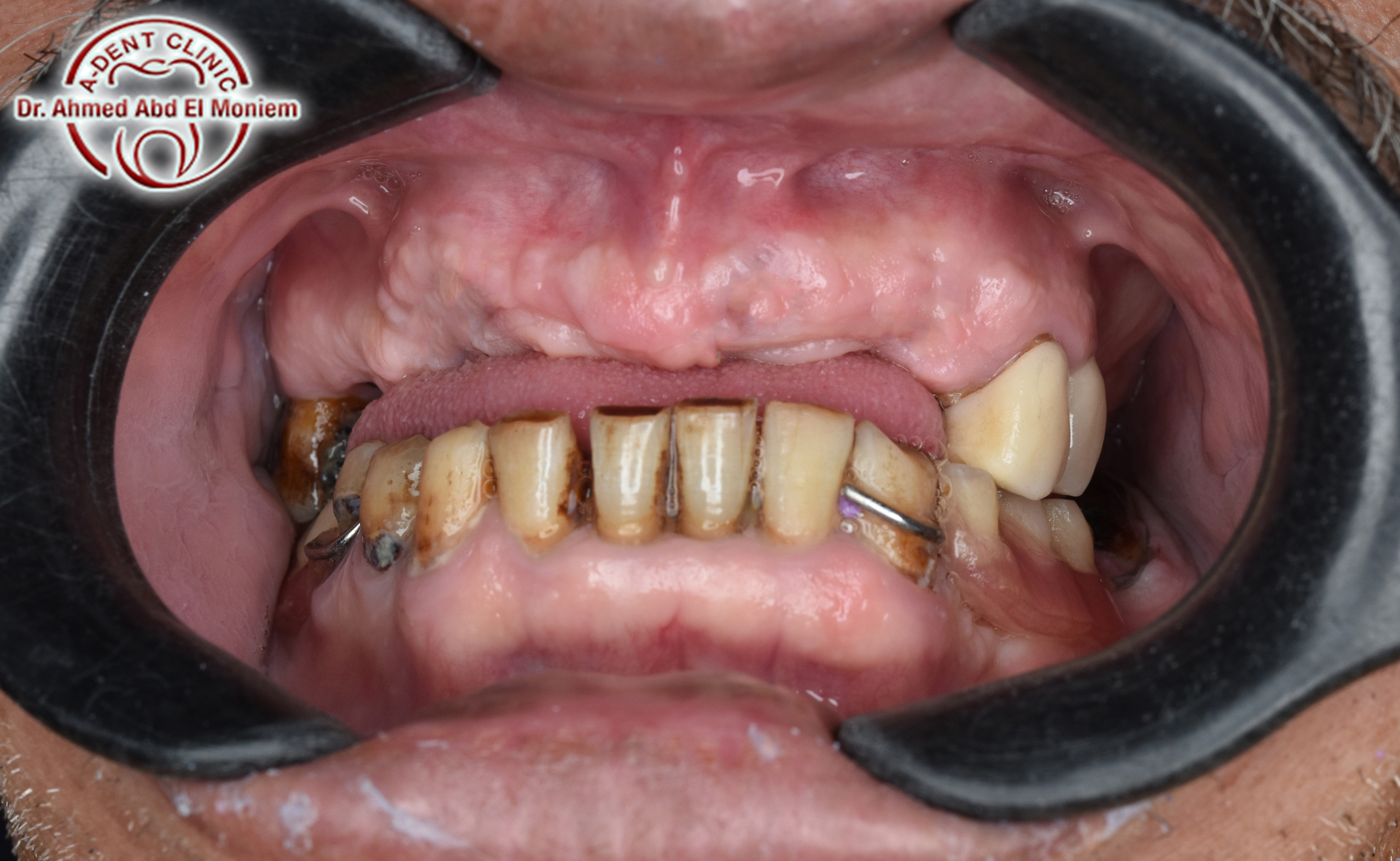 After: case 4