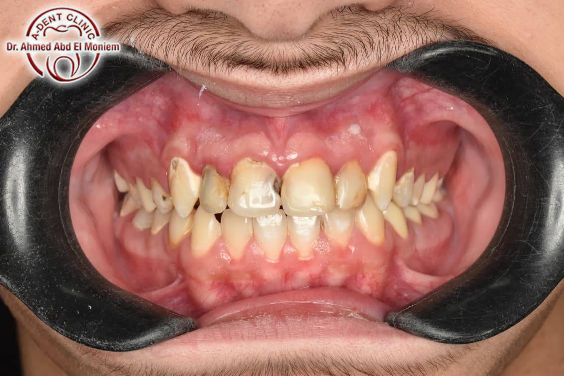 After: case 21