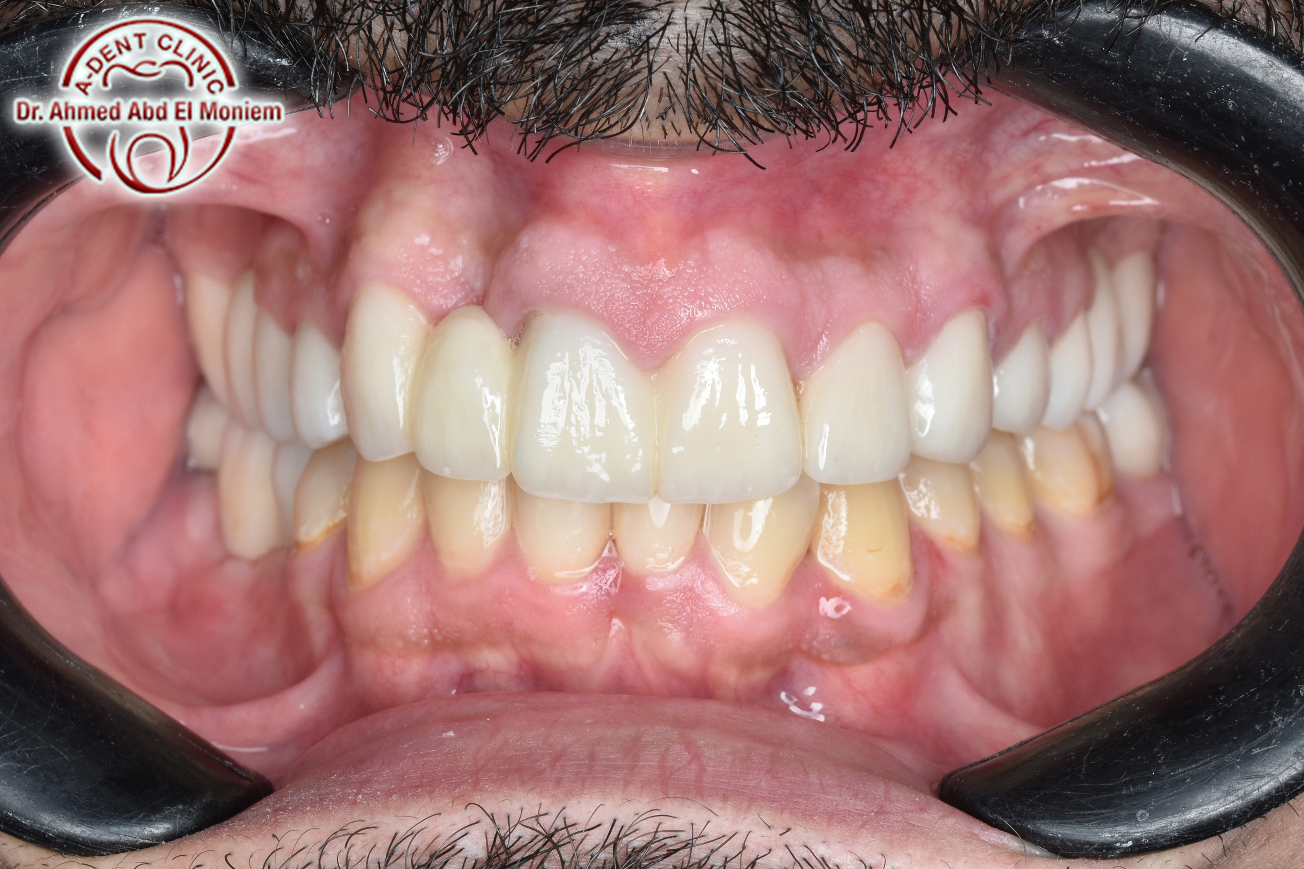 Before: case 7