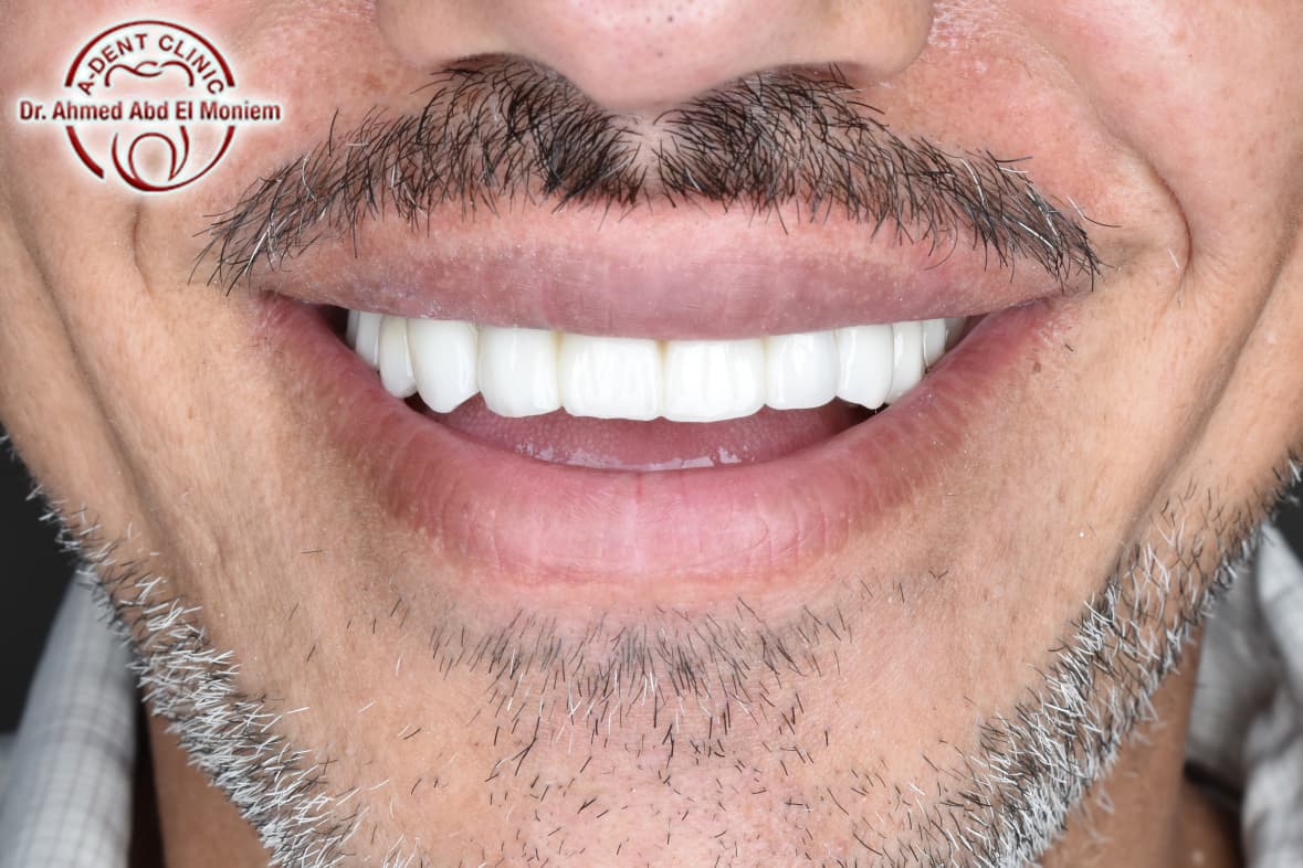 Before: case 20
