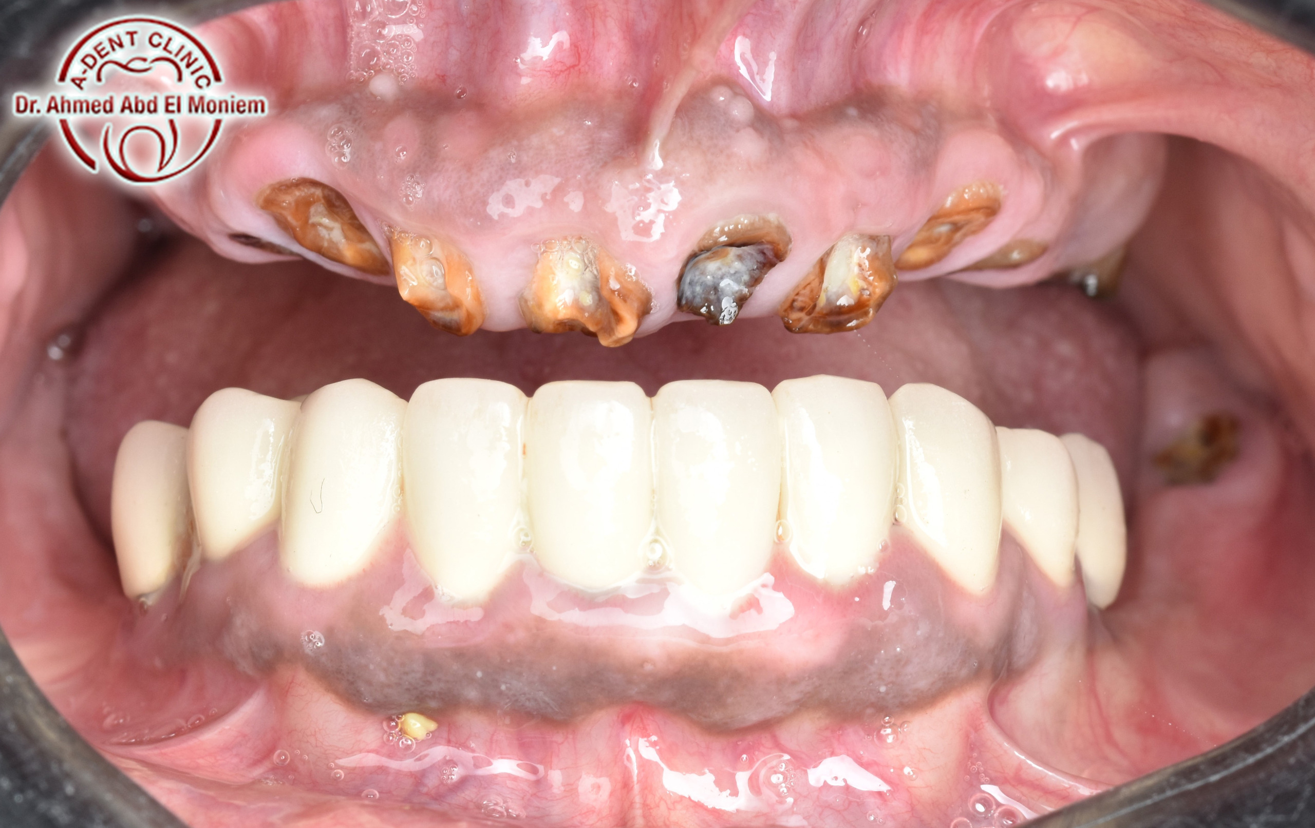 After: case 17