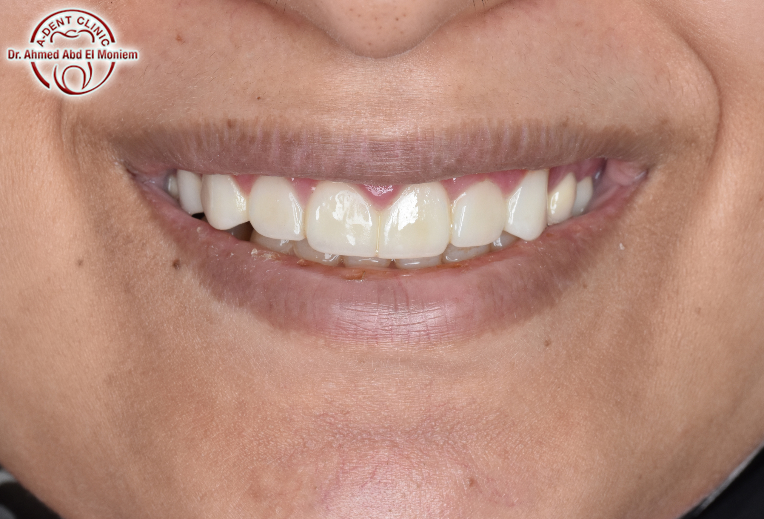Before: case 5