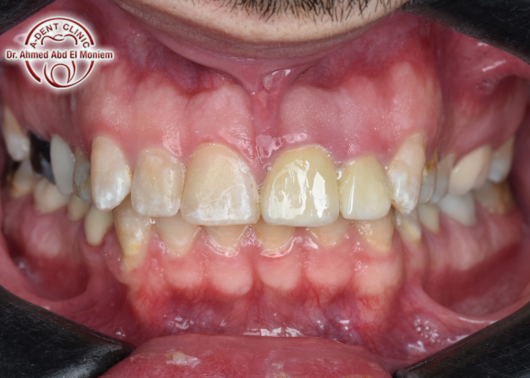 Before: case 9