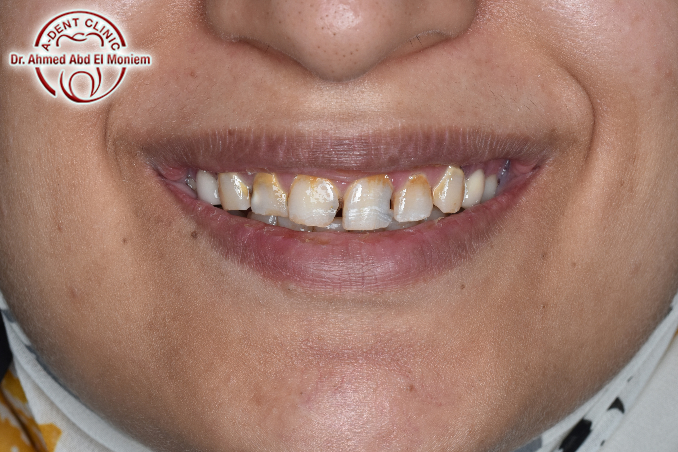After: case 5