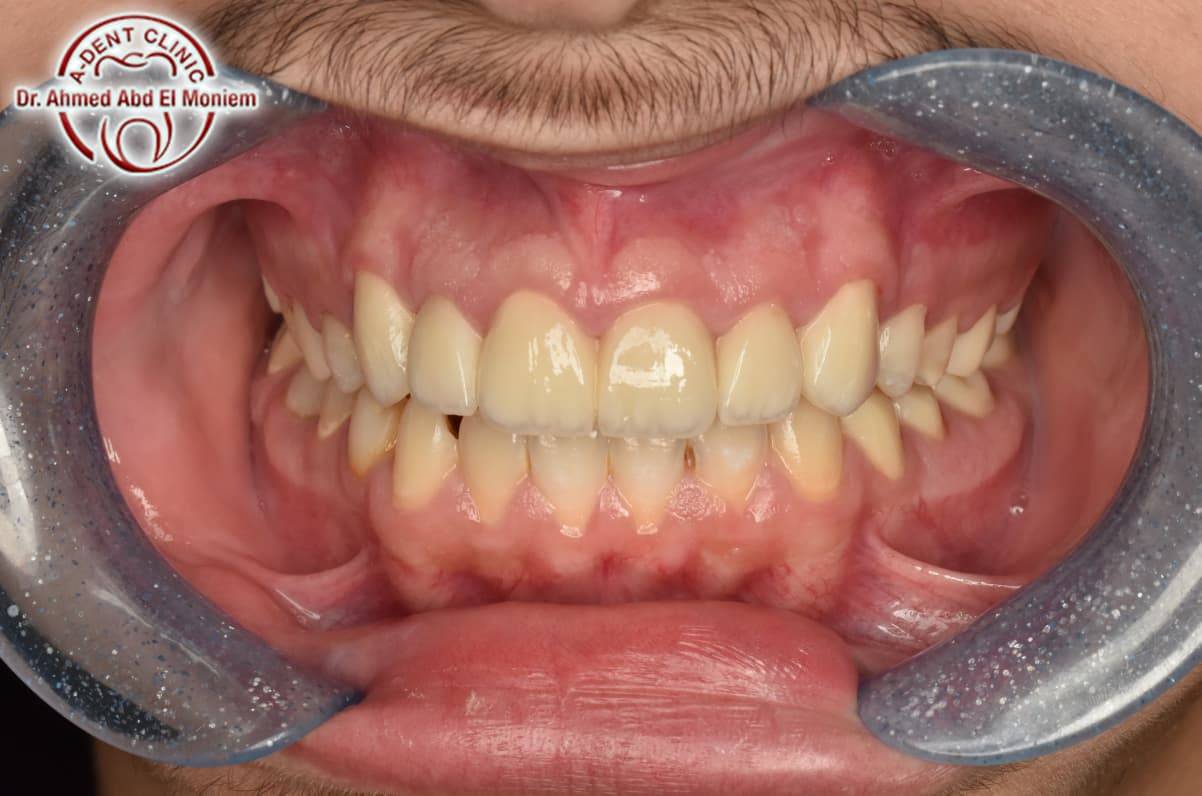 Before: case 21