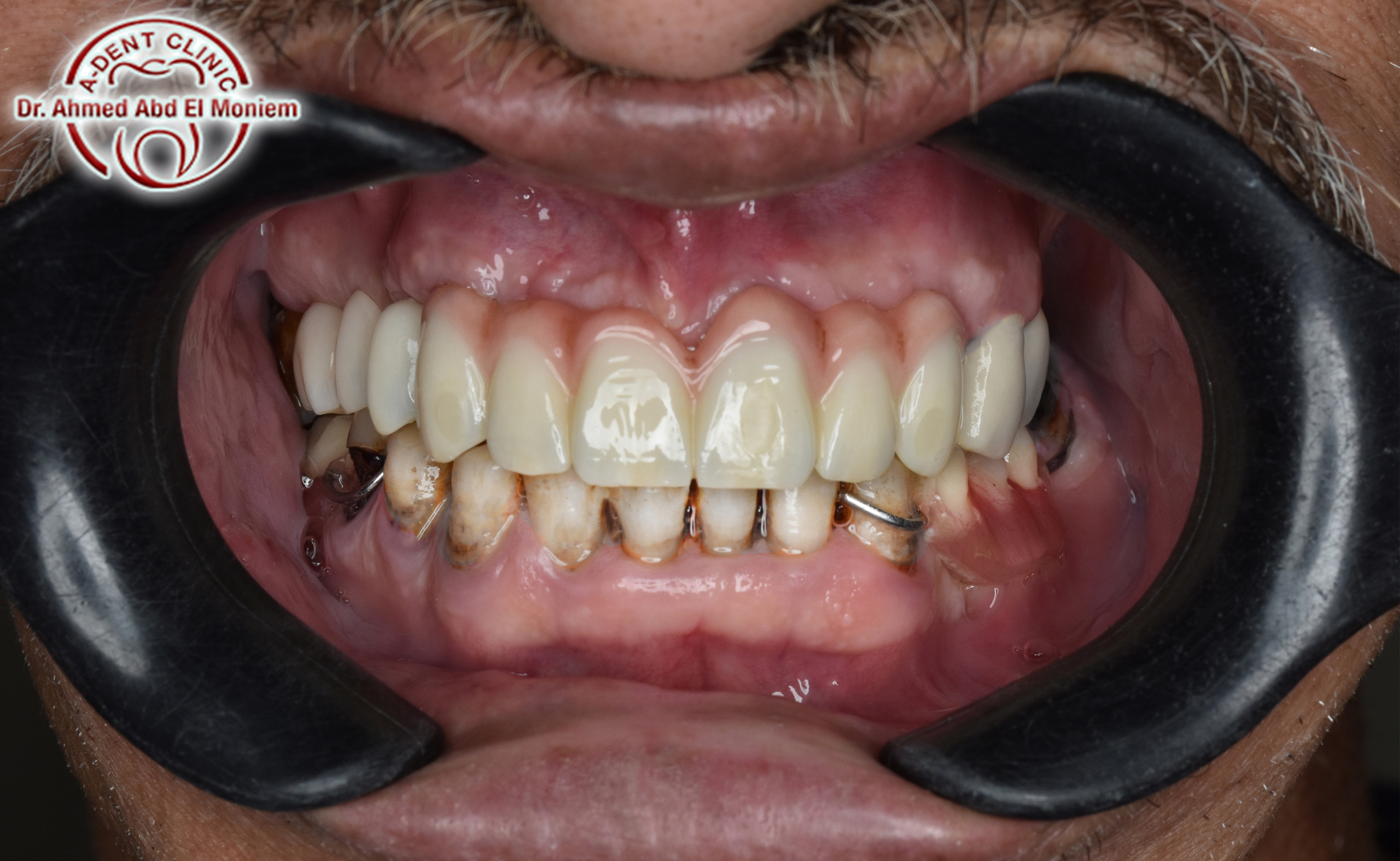 Before: case 4