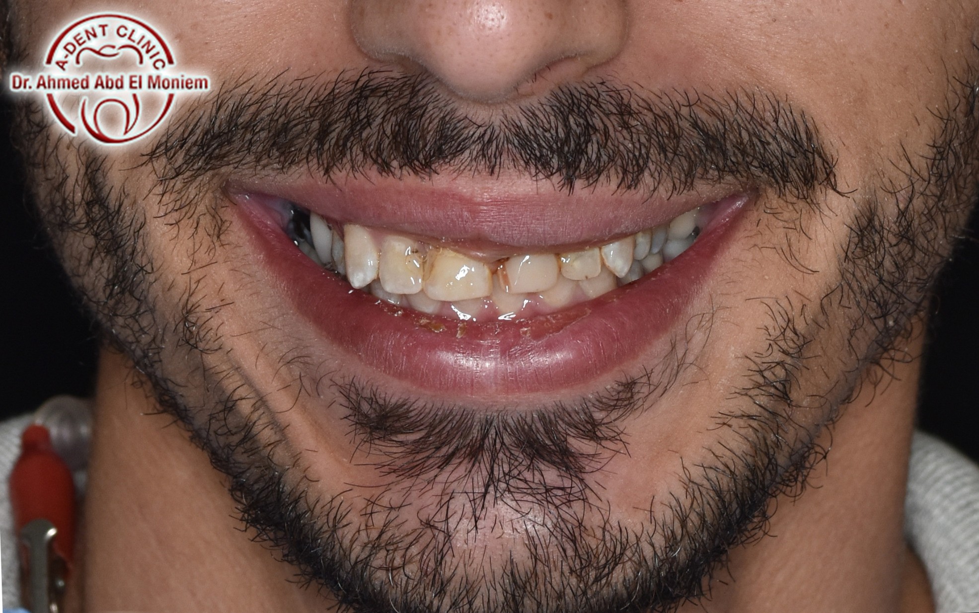 After: case 10