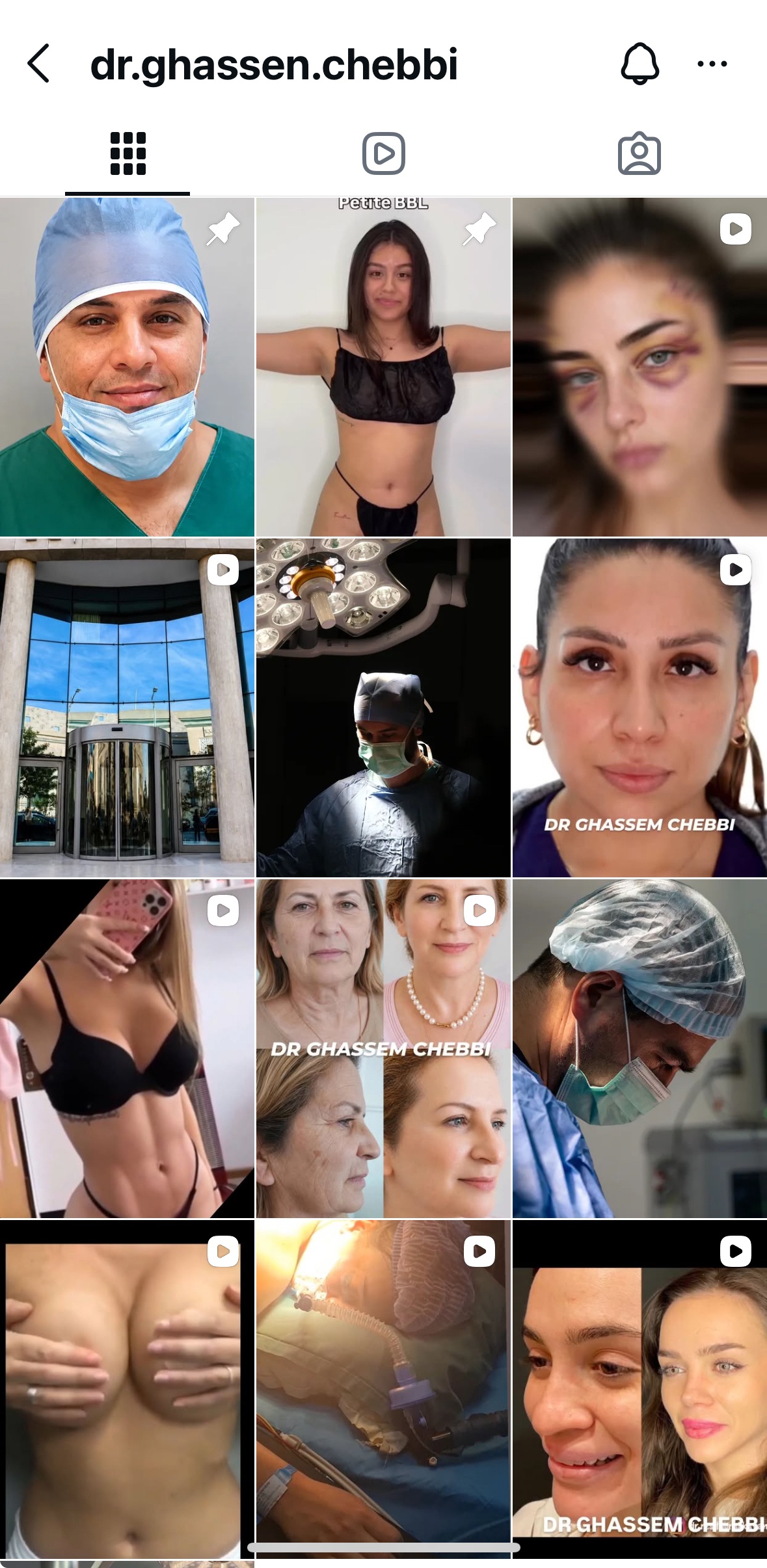 Dr Ghassen Chebbi Instagram