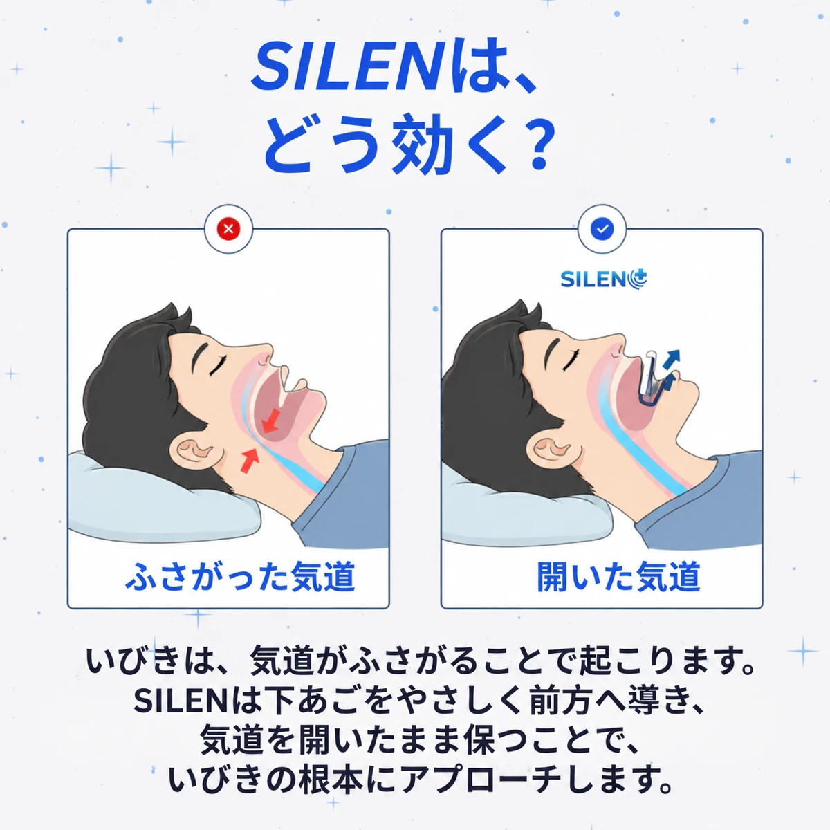SILEN いびき対策マウスピース