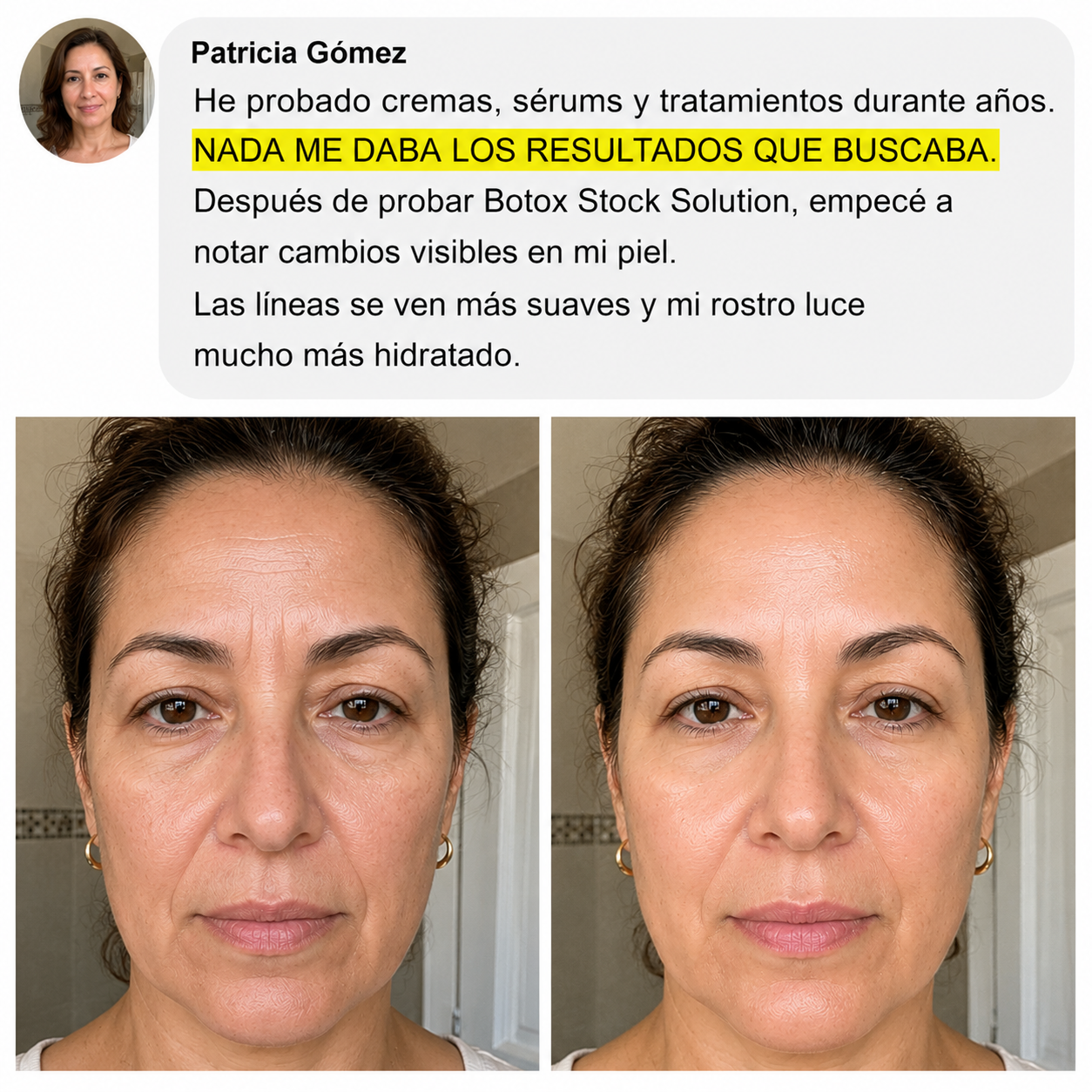 Antes y después