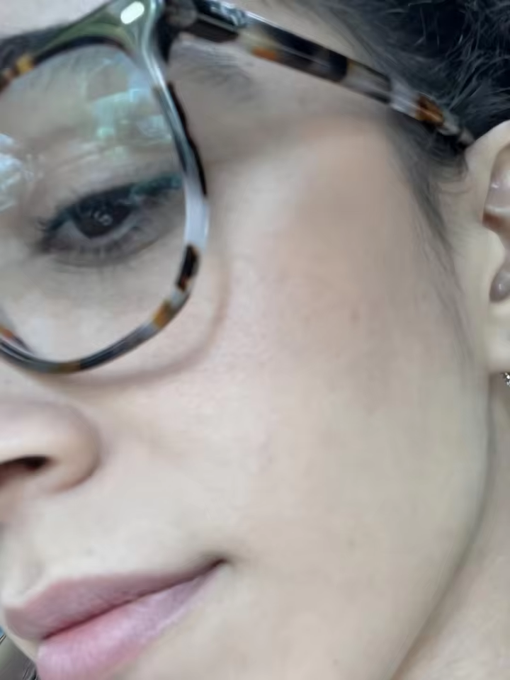 Customer close-up showing refined pores