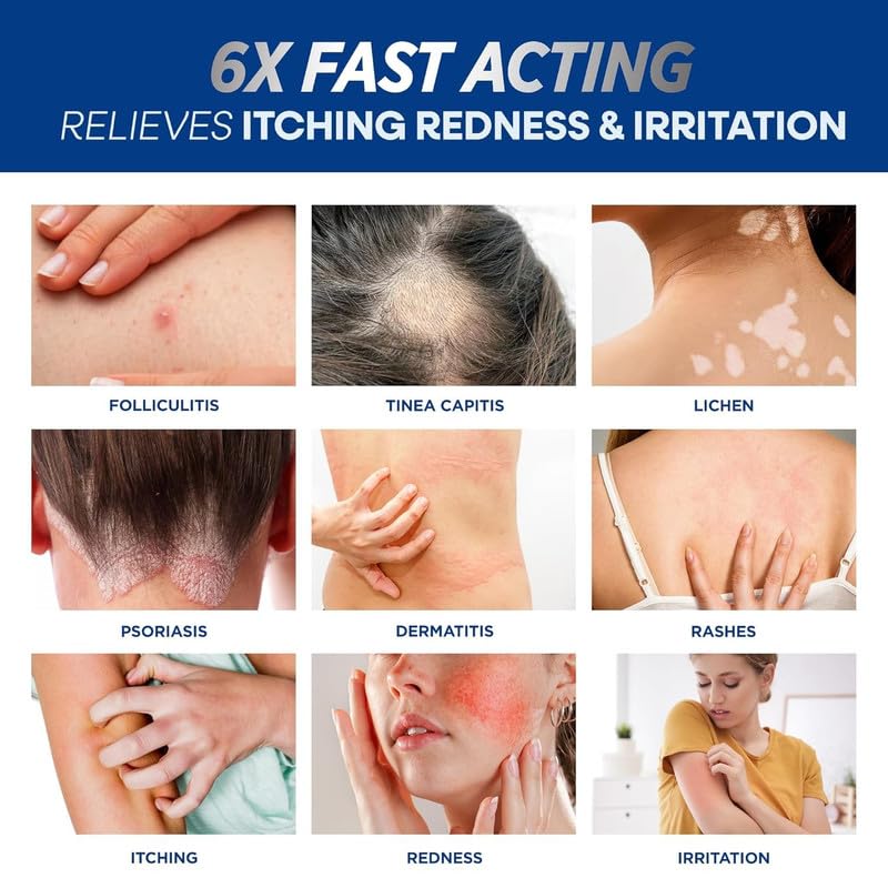 Relieves Jock Itch, Ringworm & Other Fungal Infections