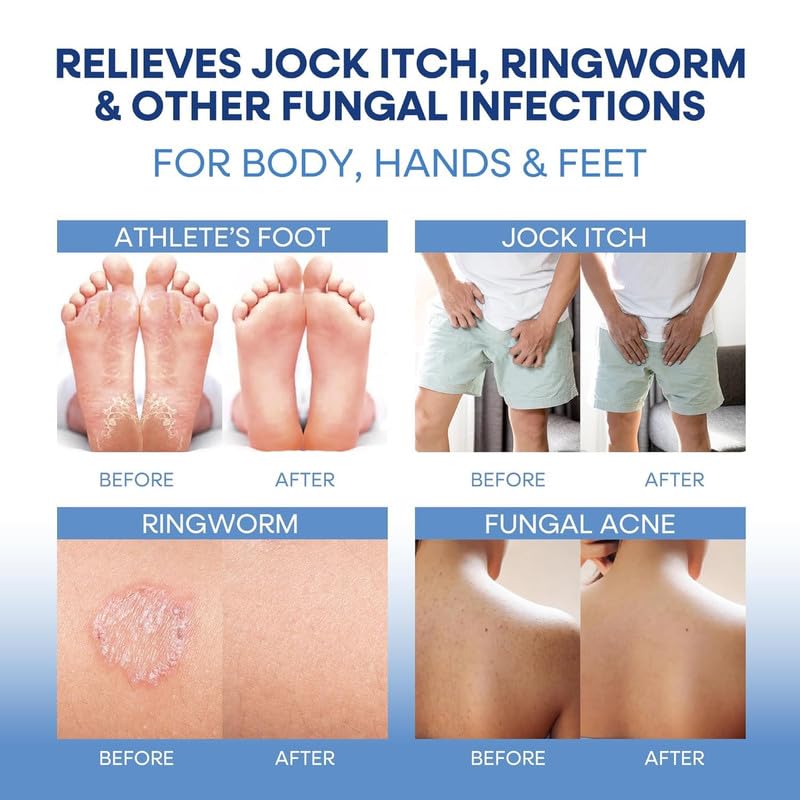 6X Fast Acting - Relieves Itching Redness & Irritation